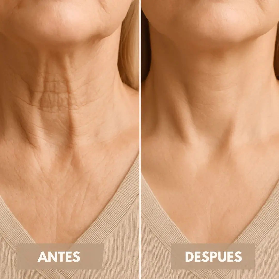 NeckLift Pro™ estiramiento facial x 40 unidades