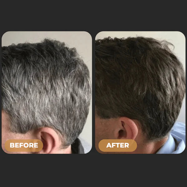 SPARTAN™ -  Tratamiento para canas en barra 2X1