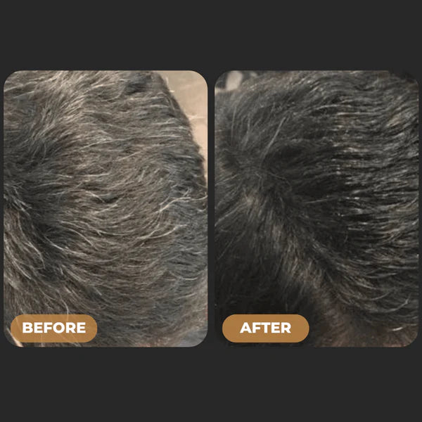 SPARTAN™ -  Tratamiento para canas en barra 2X1