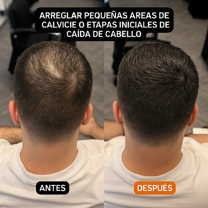 HairBear™- El truco secreto para ocultar tus entradas sin que nadie lo note