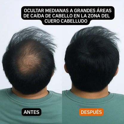 HairBear™- El truco secreto para ocultar tus entradas sin que nadie lo note