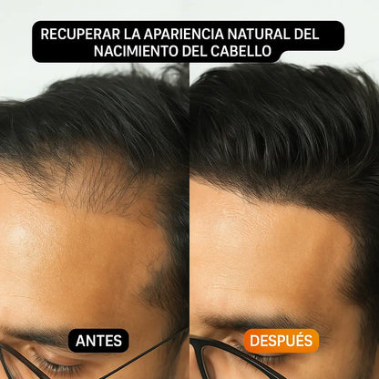 HairBear™- El truco secreto para ocultar tus entradas sin que nadie lo note